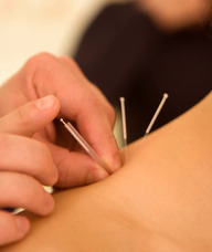 Book an Appointment with Louise A. Smith R.Ac for Registered Acupuncturist